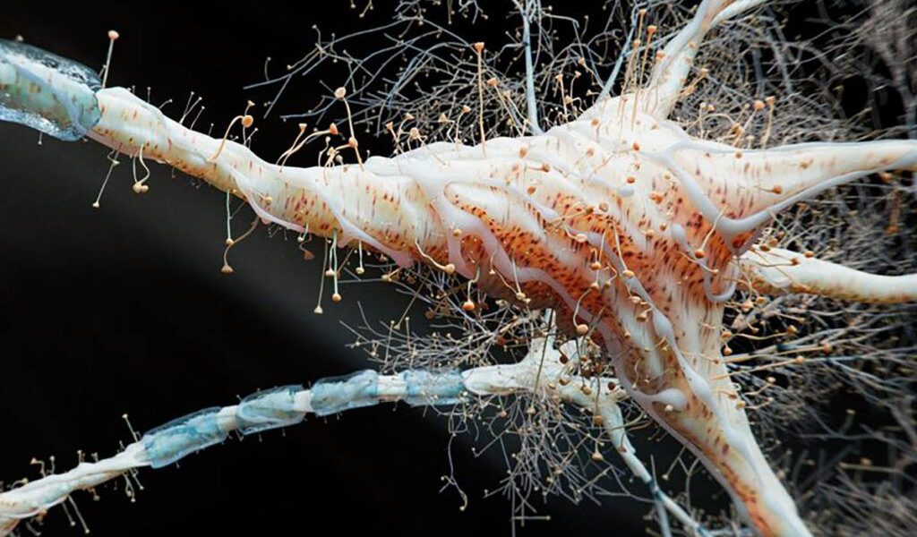 Un nou studiu revoluționează înțelegerea sclerozei multiple (SM), o boală autoimună care afectează milioane de oameni la nivel global