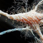 Inflamația intestinală, legătură directă cu scleroza multiplă? Studiul șoc