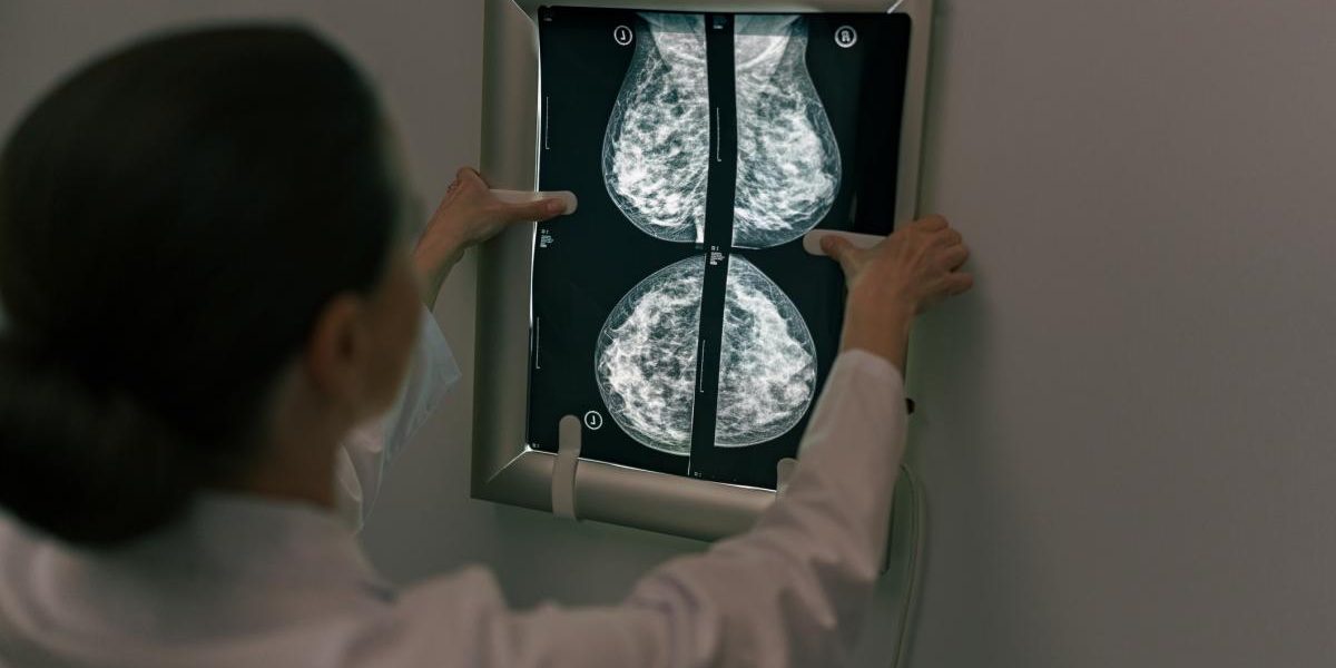 Controalele pentru cancerul de sân: Când și cum să te protejezi Depistarea precoce a cancerului de sân este crucială pentru supraviețuire
