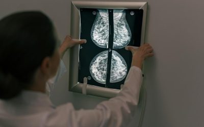 Controalele pentru cancerul de sân: Când și cum să te protejezi Depistarea precoce a cancerului de sân este crucială pentru supraviețuire