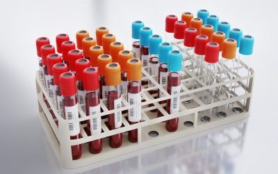 Analiza sângelui, mai precisă ca colesterolul: Riscul de infarct, detectat din timp