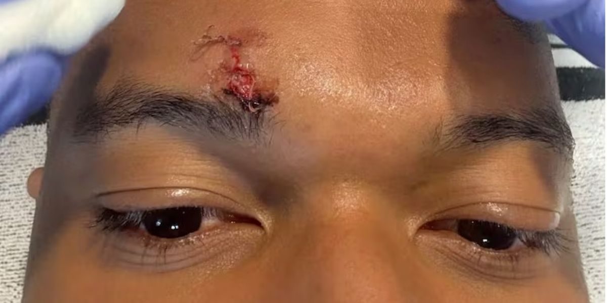 Mbappe, accidentat grav înainte de Bayern-Real Madrid: Vedeta, pe mâna medicilor