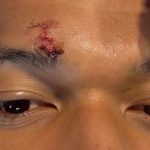 Mbappe, accidentat grav înainte de Bayern-Real Madrid: Vedeta, pe mâna medicilor