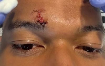 Mbappe, accidentat grav înainte de Bayern-Real Madrid: Vedeta, pe mâna medicilor