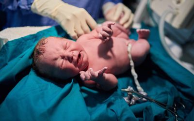 Bebelușii cu greutate mică la naștere, risc crescut de accident vascular cerebral la maturitate: Concluziile unui studiu suedez Un nou studiu realizat de cercetătorii de la Universitatea din Gothenburg, Suedia, aruncă o lumină îngrijorătoare asupra legăturii dintre greutatea la naștere și riscul de accident vascular cerebral (AVC) la vârsta adultă