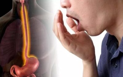 Jenantul simptom al sindromului de colon iritabil ignorat: Nu e legat de digestie