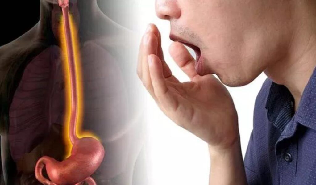 Jenantul simptom al sindromului de colon iritabil ignorat: Nu e legat de digestie