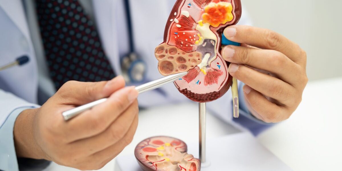 Ce ascund analizele medicale despre sănătatea rinichilor