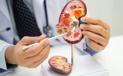 Ce ascund analizele medicale despre sănătatea rinichilor
