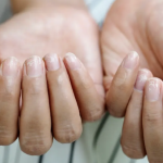 Unghiile Terry: Semnalul ascuns al bolilor grave. Ce indică, de fapt?