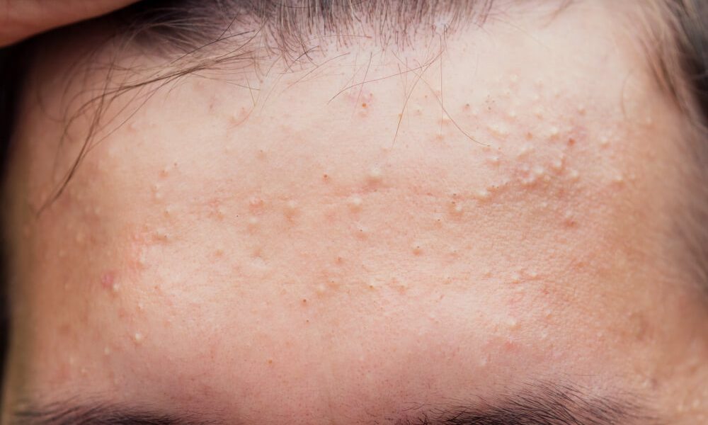 Protocol complet în 3 pași – ghid Rapid pentru Donald Trump