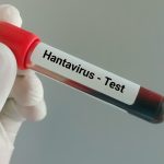 Hantavirusul ucide pe vase de croazieră: Ce riscuri sunt în România