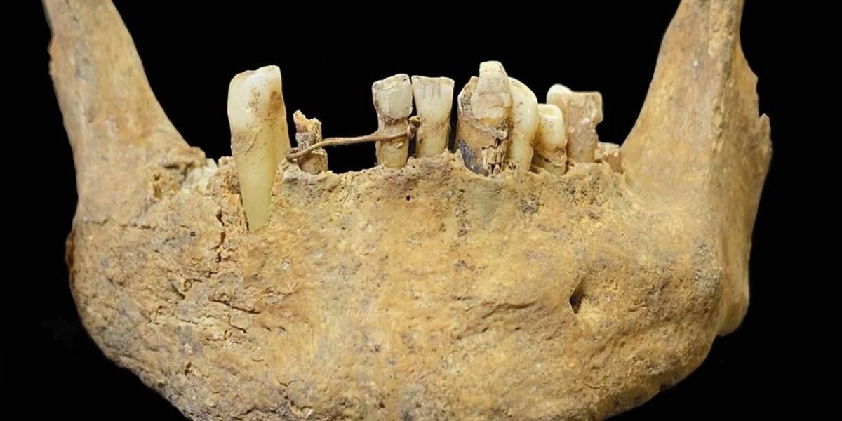 Schelet medieval cu mister: Ce ascundea între dinți, de fapt?