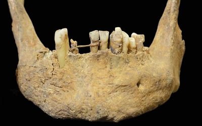 Schelet medieval cu mister: Ce ascundea între dinți, de fapt?