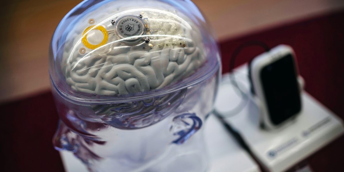 China, un pas înaintea lui Musk: Primul implant cerebral comercial, ajutor pentru paralizați