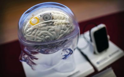 China, un pas înaintea lui Musk: Primul implant cerebral comercial, ajutor pentru paralizați