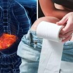 Cancer hepatic: Avertisment despre simptome timpurii importante