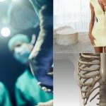 Femei își rup coastele pentru o talie subțire. Medici îngrijorați